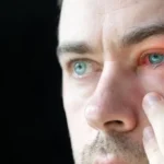 kirmizi goz riskine karsi deniz ve havuzda uv korumali gozluk onerisi rJg1KZhb