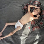 israilin kitliga surukledigi 10 yasindaki nafiz kemik yiginina donustu 6tT6zce1