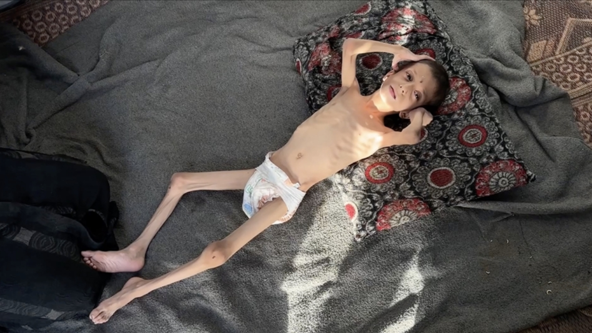 israilin kitliga surukledigi 10 yasindaki nafiz kemik yiginina donustu 6tT6zce1