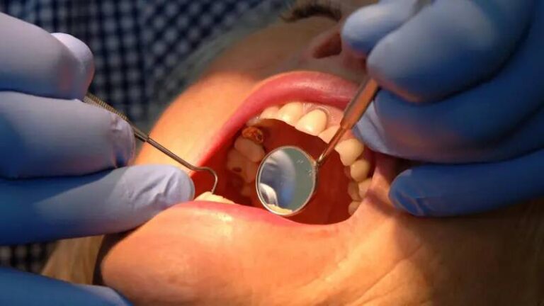 dis minesini onaran yeni jel curuklerin sonu mu geliyor Ct7mPytZ.jpg