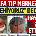 alfa-tip-merkezinde-sac-ekiyoruz-dediler-hayati-zehir-ettiler-jTg7KEhR.png