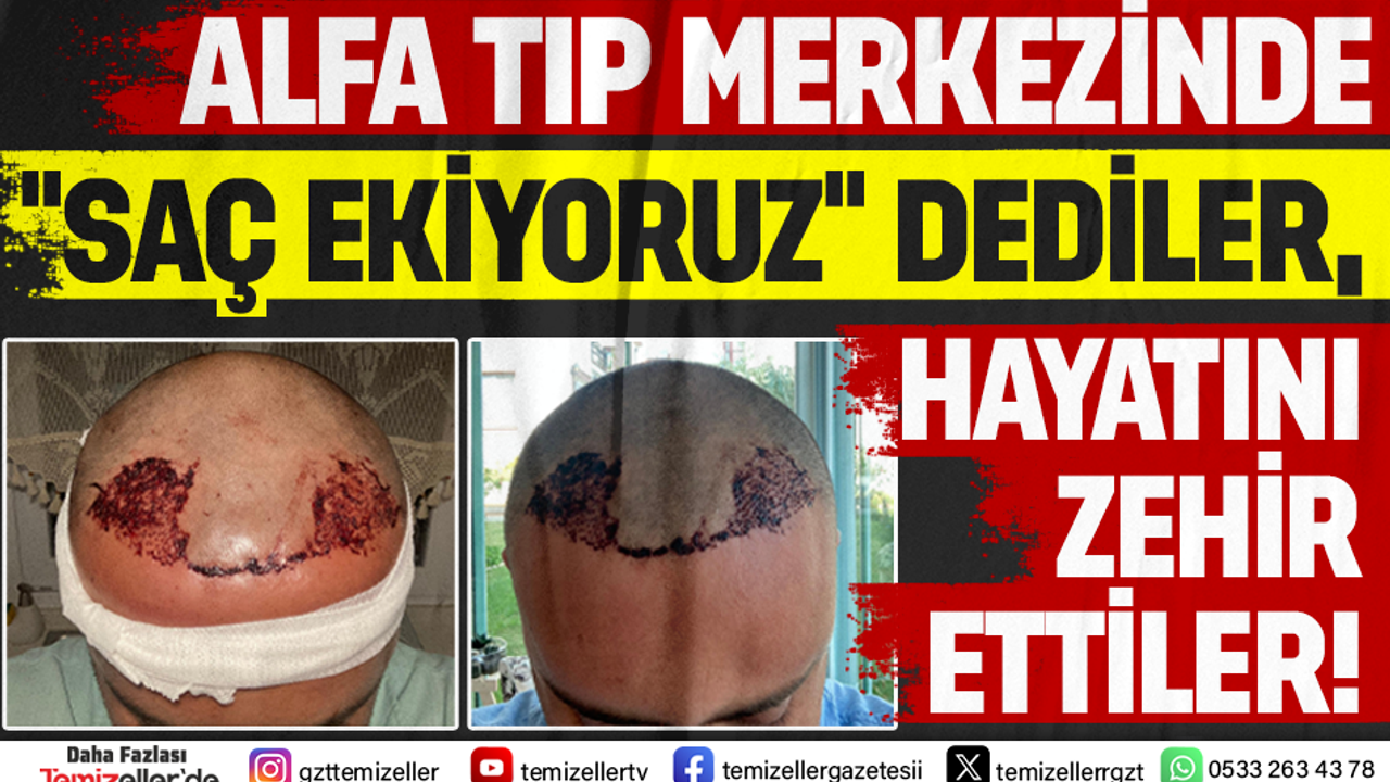 alfa-tip-merkezinde-sac-ekiyoruz-dediler-hayati-zehir-ettiler-jTg7KEhR.png